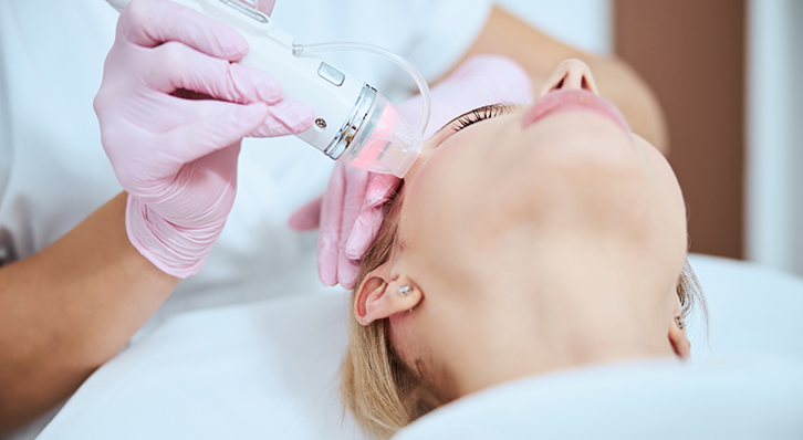 Radiofrekwencja mikroigłowa