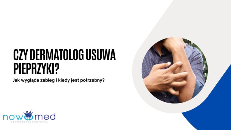 Czy dermatolog usuwa pieprzyki? Jak wygląda zabieg i kiedy jest potrzebny?